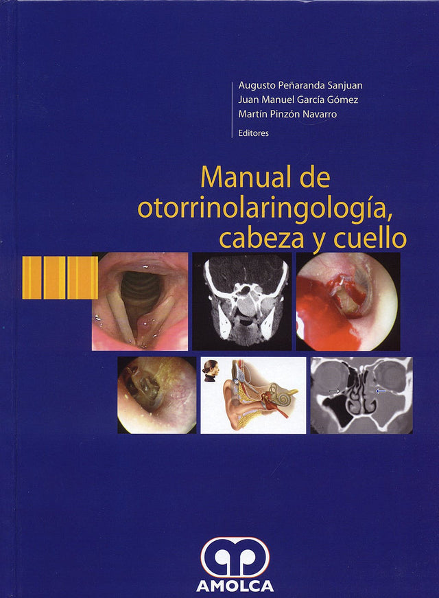 Augusto Peñaranda. Manual de Otorrinolaringología, Cabeza y Cuello. 1a. ed. 2007