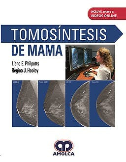 Liane E. Philpotts. Tomosíntesis de Mama. 1a. ed. 2018