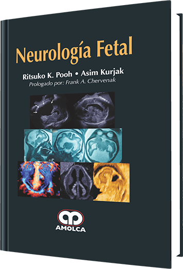 Ritsuko K. Pooh. Neurología Fetal. 1a. ed. 2011