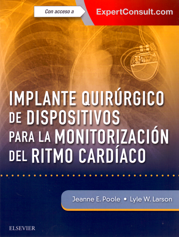 Poole. Jaenne. Implante quirúrgico de dispositivos para la monitorización del ritmo cardíaco 1ra ed. 2018