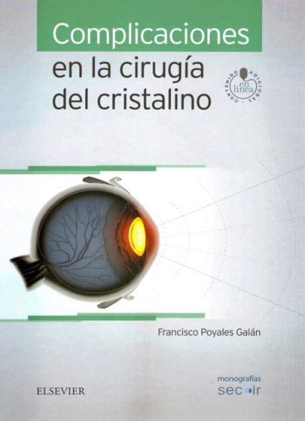 Poyales Galán. Francisco. Complicaciones en la cirugía del cristalino 1ra ed. 2016