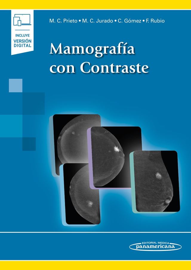 Prieto Falcón. Mara del Carmen. Mamografía con Contraste. 1ra ed. 2022