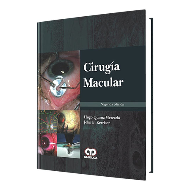 Hugo Quiroz Mercado. Cirugía Macular. 2a. ed. 2013