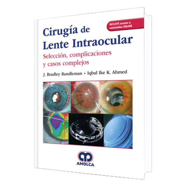 J. Bradley Randleman. Cirugía de Lente Intraocular. Selección, complicaciones y casos complejos. Incluye acceso Online. 1a. ed. 2019