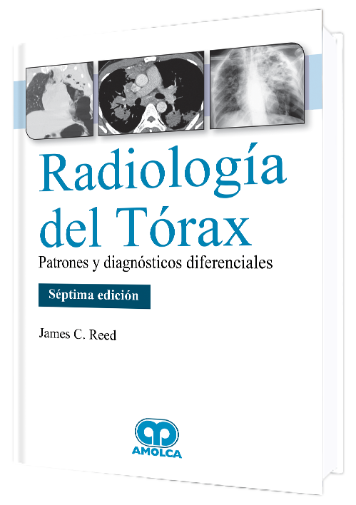 Radiología del Tórax. Patrones y diagnósticos diferenciales. 7a. ed. 2019
