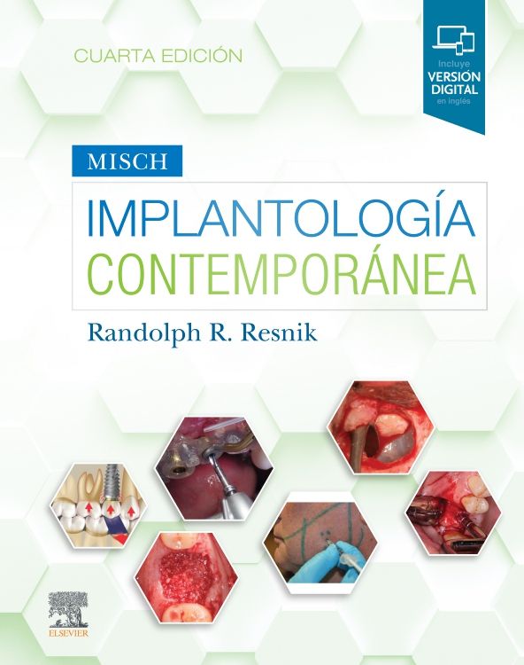 Resnik R Rndolph. Misch. Implantología contemporánea 4ta ed. 2021