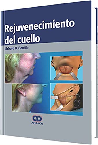 Richard D. Gentile Rejuvenecimiento del Cuello 1ra ed. 2013