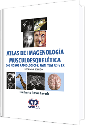 Humberto Rosas Lavado. Atlas de Imagenología Musculoesquelética. 200 Signos Radiológicos:RMN, TEM, US y RX. 2da. ed. 2018