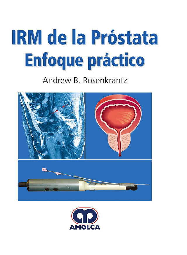 Andrew B. Rosenkrantz. IRM de la Próstata Enfoque Práctico. 1a. ed. 2018