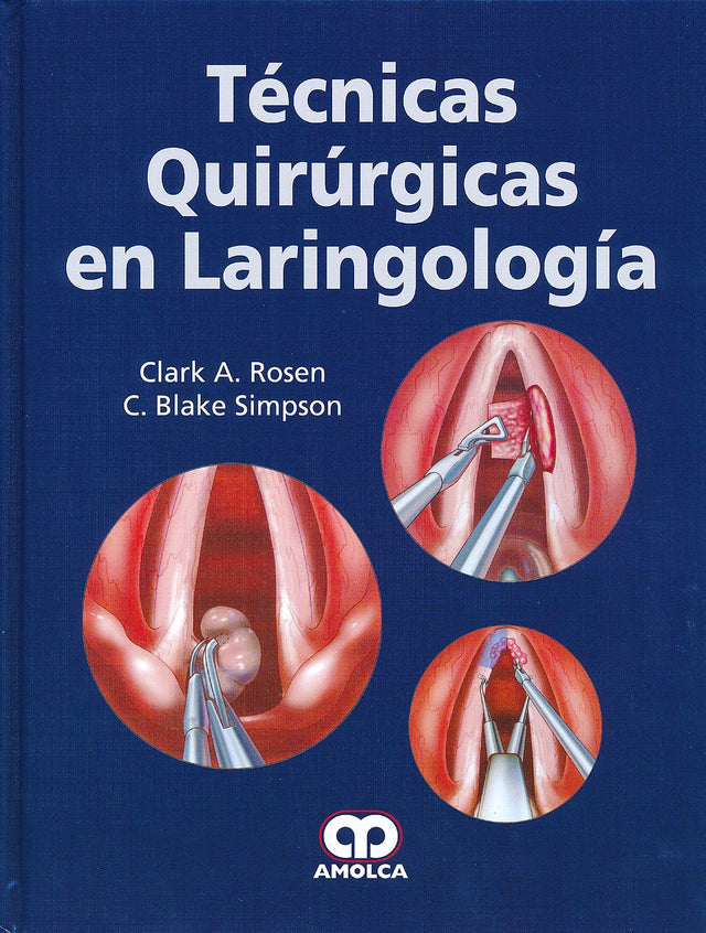 Clark A. Rosen, MD. Técnicas Quirúrgicas en Laringología. 1a. ed. 2013