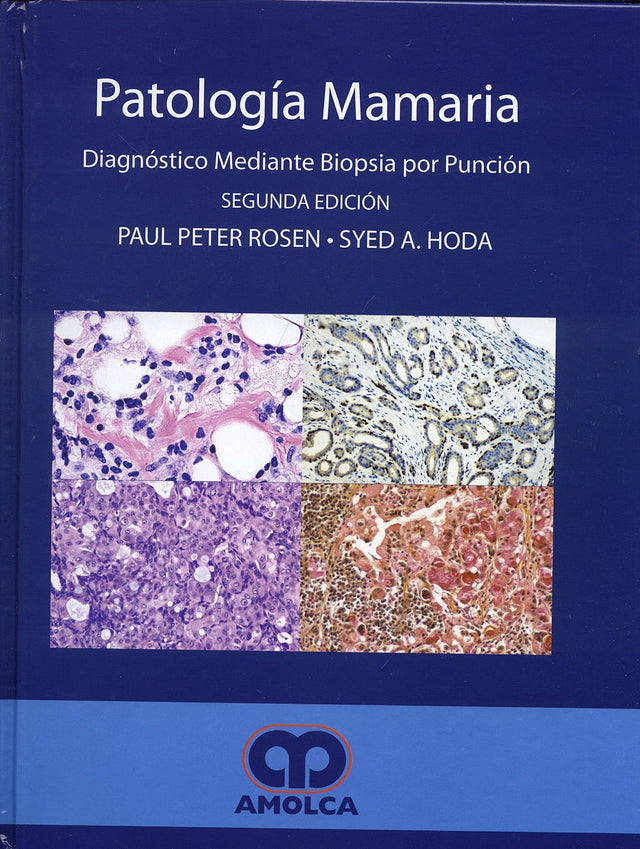 Paul Peter Rosen. Patología Mamaria. 2a. ed. 2007
