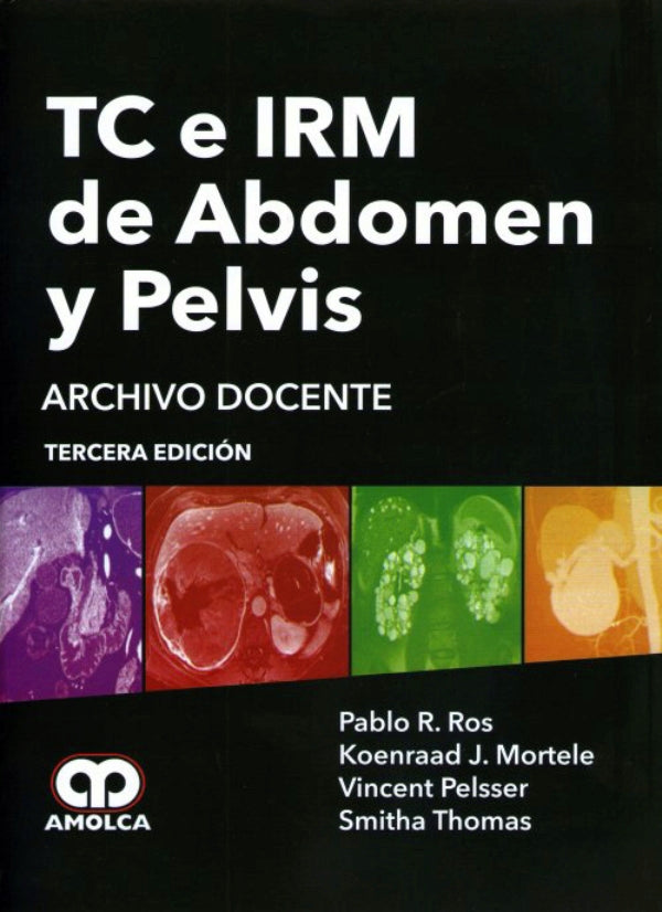 Pablo R. Ros. TC e IRM de Abdomen y Pelvis. 3a. ed. 2015