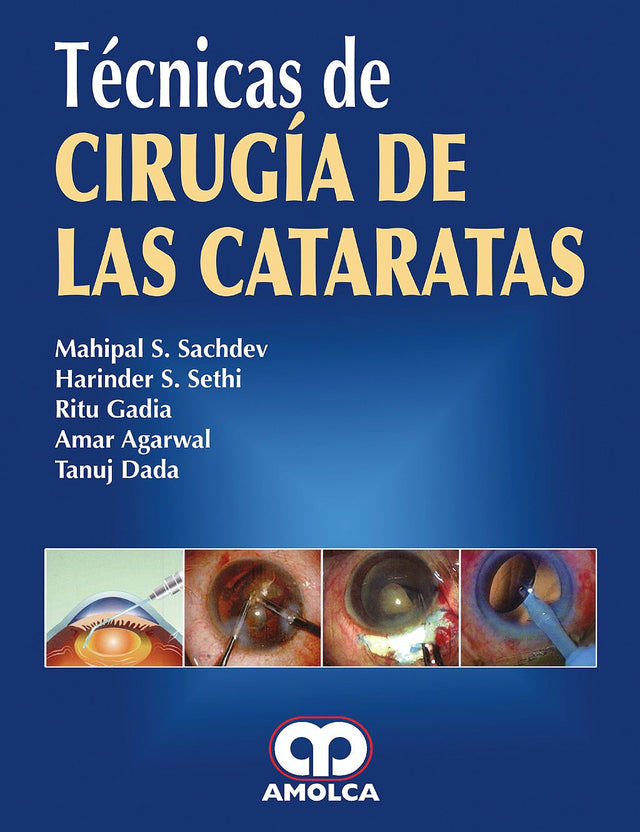 Mahipal S. Sachdev. Técnica Cirugía de las Cataratas. 1a. ed. 2008