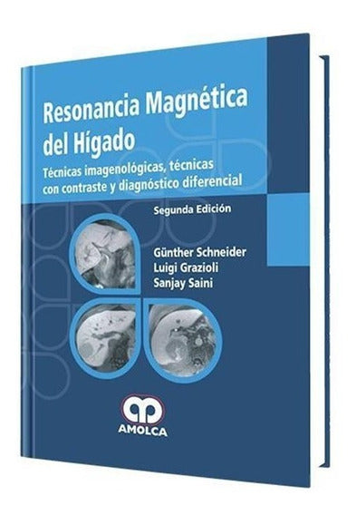 Günther Schneider. Resonancia Magnética Hígado, 2a. ed. 2008