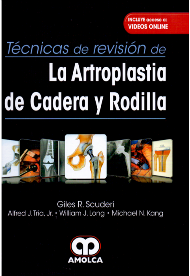 Giles R. Scuderi. Técnicas de Revisión de la Artroplastia de Cadera y Rodilla. Acceso a videos On-line. 1a. ed. 2017