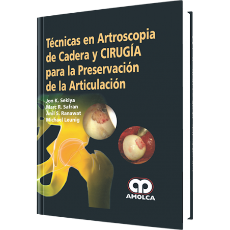 Jon K. Sekiya. Técnicas en Artroscopia de Cadera y Cirugía. 1a. ed. 2013