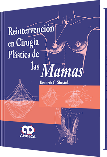 Kenneth C. Shestak. Reintervención en Cirugía Plástica de las Mamas. 1a. ed. 2009