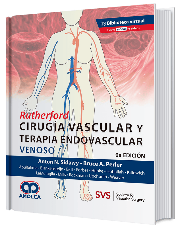 Anton N. Sidawy. Rutherford Cirugía Vascular y Terapia Endovascular. Venoso.E-Book. Videos. 9ª. ed. 2020