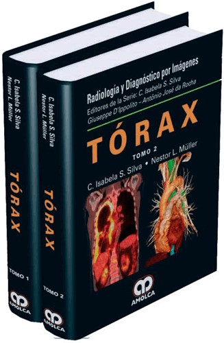 C. Isabela S. Silva. Radiología  y Diagnóstico por imágenes Tórax. Tomos I - II. 1a. ed. 2016