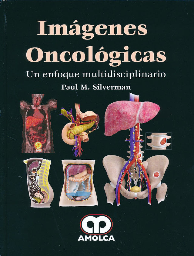 Paul M. Silverman. Imágenes Oncológicas. Un enfoque multidisciplinario. Incluye DVD. 1a. 2014