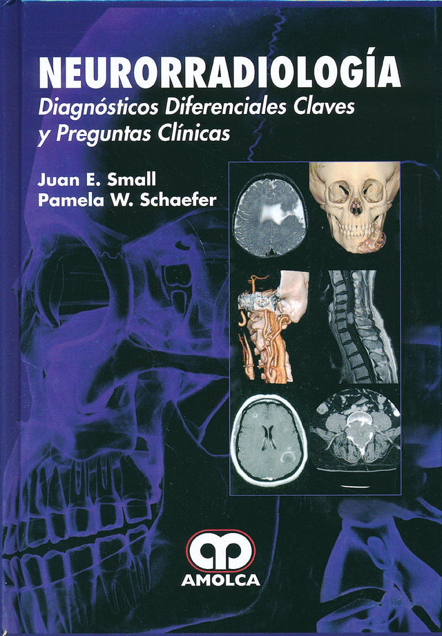 Juan E. Small. Neurorradiología Diagnóstico Diferenciales Claves y Preguntas Clínicas. 1a. ed. 2015