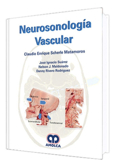Claudio E. Scherle Matamoros. Neurosonología Vascular. 1a. ed. 2018