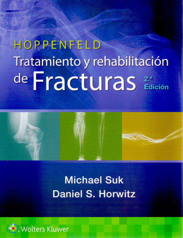 Suk Michael. Hoppenfeld. Tratamiento y rehabilitación de fracturas. 2a ed. 2022