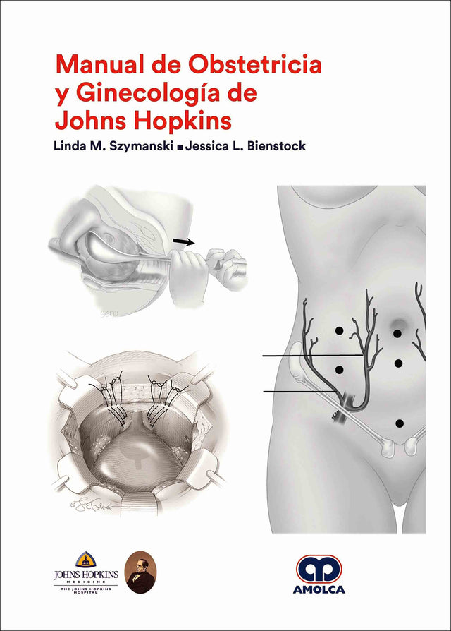 Linda M. Szymanski. Manual de Obstetricia y Ginecología de Johns Hopkins. 1a. ed. 2019