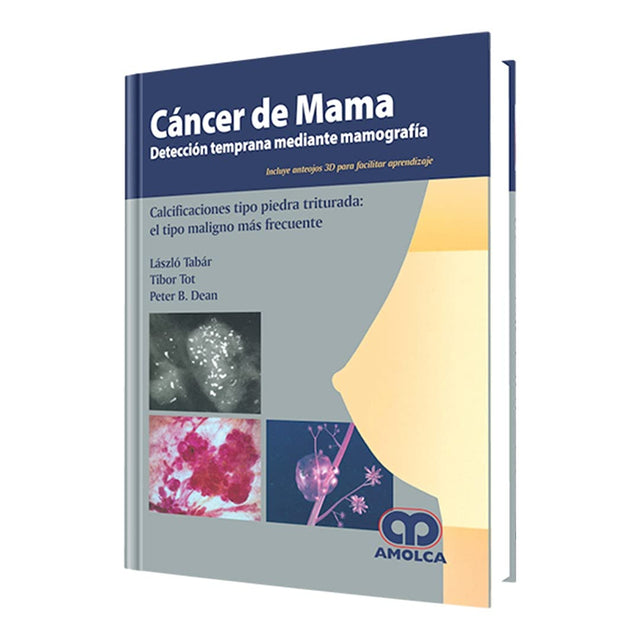László Tabár. Cáncer de Mama. Detección Temprana Mediante Mamografía.
