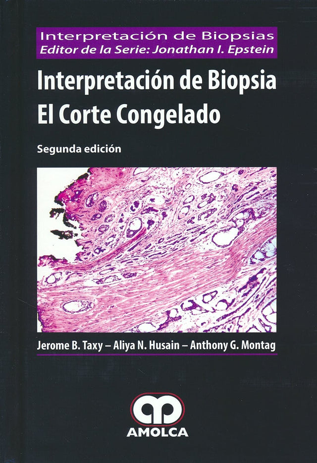 Jerome B. Taxy. Interpretación de Biopsia el Corte Congelado. 2a. ed. 2016