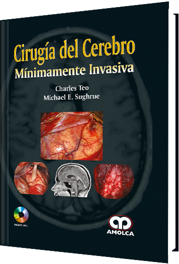 Charles Teo. Cirugía del Cerebro Mínimamente Invasiva. 1a. ed. 2017