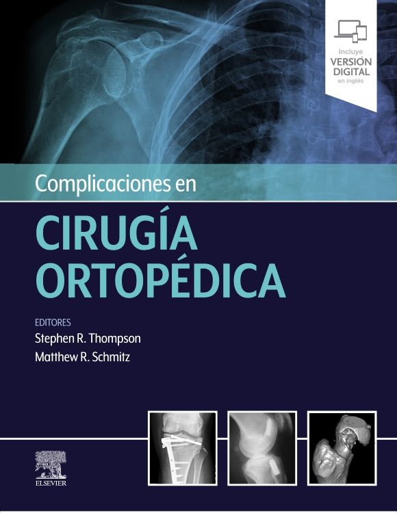 Thompson R. Stephen. Complicaciones en cirugía ortopédica 1ra ed. 2021