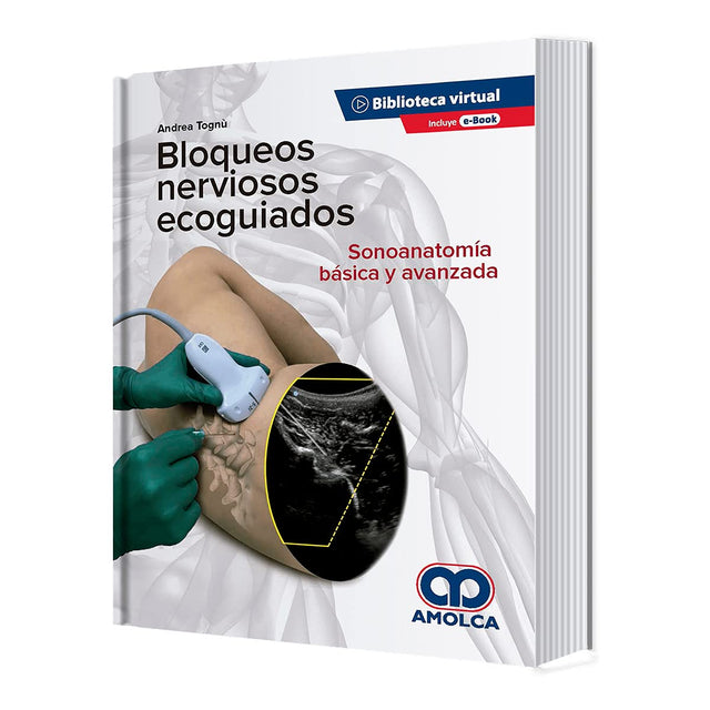 Andrea Tognú. Bloqueos Nerviosos Ecoguiados. Sonoanatomía Básica y Avanzada. E-Book. 1a. ed. 2020