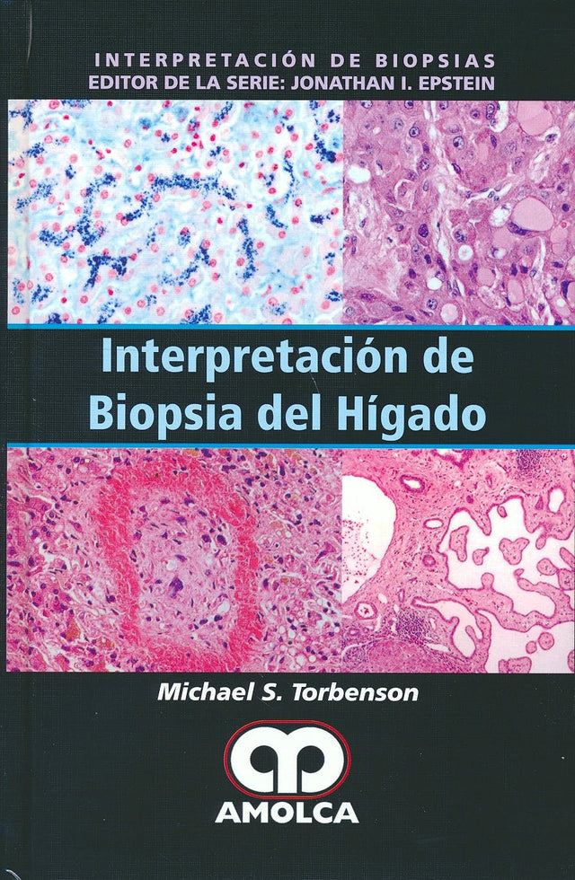 Michael S. Torbenson. Interpretación de Biopsia del Hígado. 1a. ed. 2017