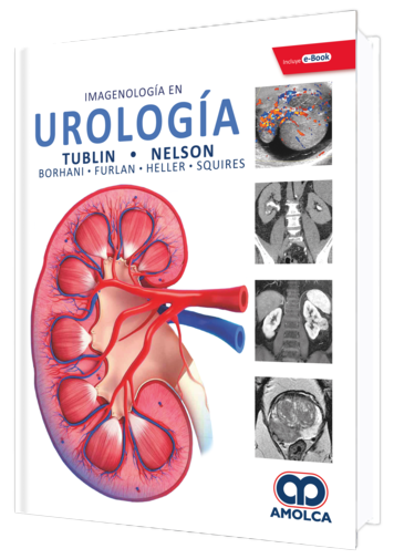 Mitchell E. Tublin. Imagenología en Urología.  Incluye e-Book. 1a. ed. 2019