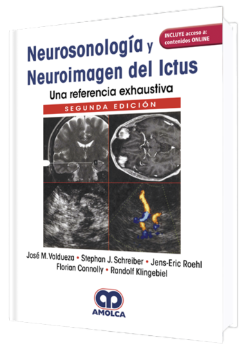 José M. Valdueza. Neurosonología y Neuroimagen del Ictu. Una referencia exhaustiva. Incluye acceso Online. 2a. ed. 2019