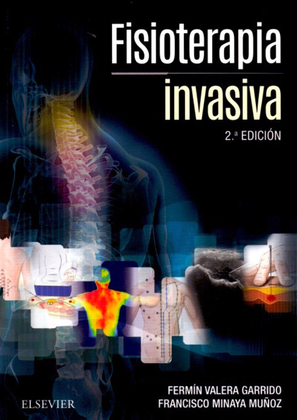 Valera Garrido. Fermín. Fisioterapia invasiva. 2da ed. 2016