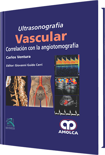 Carlos Ventura. Ultrasonografía Vascular. Correlación con la Angiotomografía.