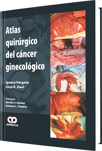 Ignace Vergote. Atlas de Cirugía de Cáncer Ginecológico. 1a. ed. 2010