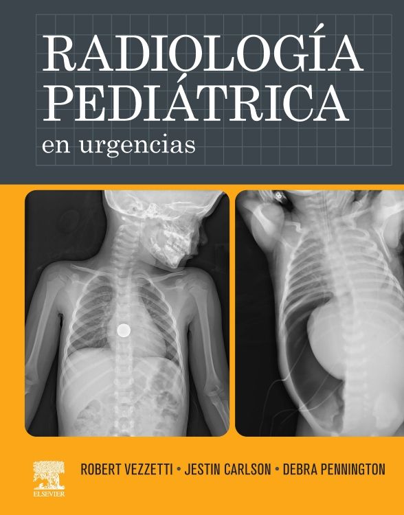 Vezzetti Robert. Radiología pediátrica en urgencias. 1a ed. 2023
