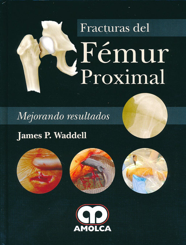 James P. Waddell. Fracturas del Fémur Proximal. 1a. ed. 2013