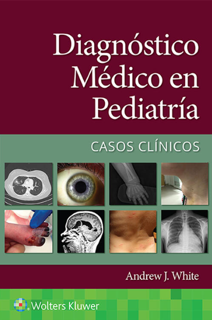 White J. Andrew. Diagnóstico médico en pediatría. Casos clínicos. 1a ed. 2022
