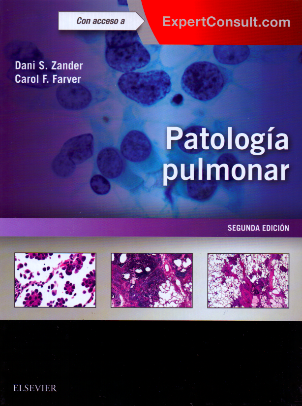 Zander, D. S., Patología pulmonar 2 ed. © 2018