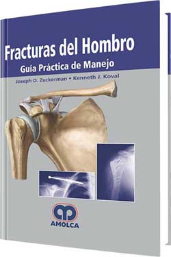 Joseph D. Zuckerman. Fracturas del Hombro. 1a. ed. 2007