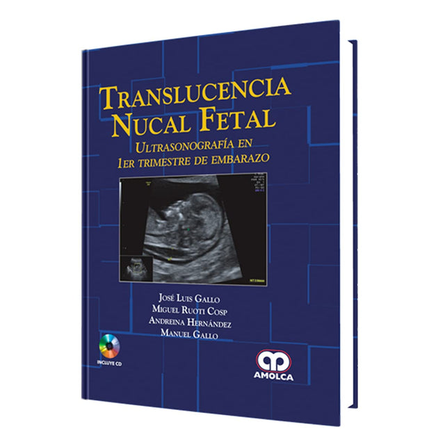 José Luis Gallo Translucencia Nucal Fetal. Ultrasonografía en 1er Trimestre de Embarazo 1ra ed 2016