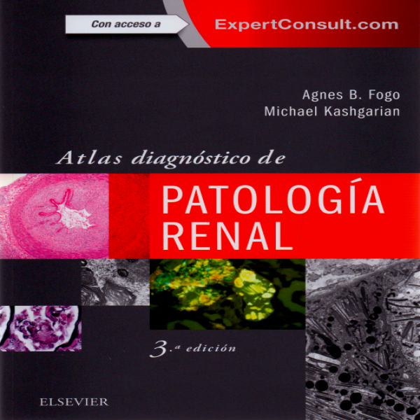 Fogo, A.B., Atlas diagnóstico de patología renal 3 ed. © 2018
