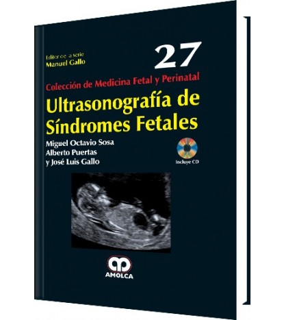 Miguel Octavio Sosa Ultrasonografía de Síndromes Fetales No. 27