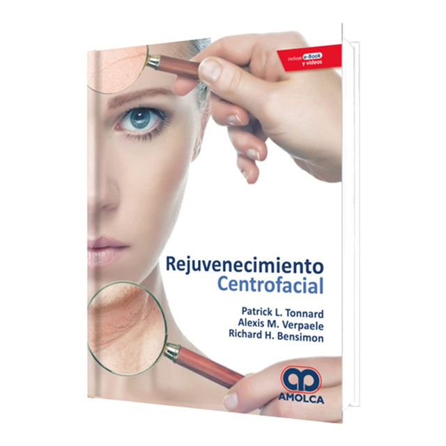 Patrick L. Tonnard Rejuvenecimiento Centrofacial.  Incluye e-Book y videos 1ra ed. 2019