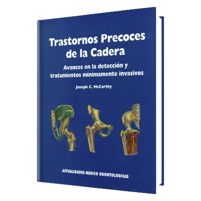Joseph C. McCarthy Trastornos Precoces de la Cadera 1ra ed  2006